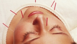 Akupunkturun Uyarı Noktaları