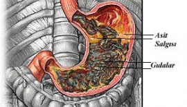 Akut Ve Kronik Gastrit