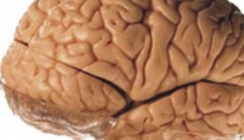 Amorotik Kalıtsal Akıl Geriliği