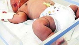 Anomalili Kusurlu Bebekler