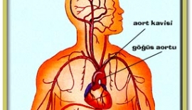 Aort Hastalıkları