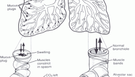 Astımın Belirtileri Nelerdir?
