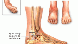 Ayak Ağrıları