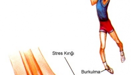 Ayak Bileği Burkulması