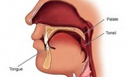 Bademciklerin ve Adenoitlerin Alınması