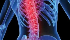 Bel Fıtığı Nedir?