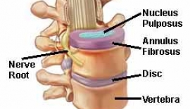 Boyun Ağrıları Boyun Fıtığı