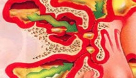 Burun Sinüsleri Nedir?