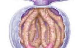 Glomerünolefritin Nedenleri