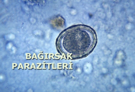 Barsak Parazitleri