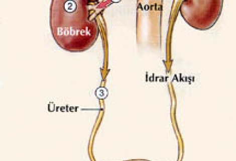 Böbrek Kanallarında Genişleme